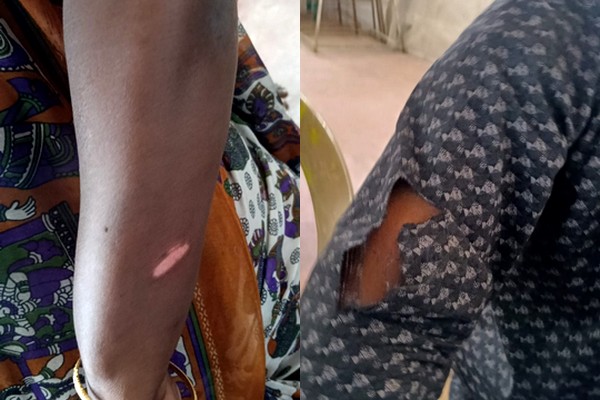 தீண்டாமை சுவரை அகற்ற போராட்டம்… கம்யூனிஸ்ட் கட்சியினர் மீது கண்மூடி தாக்குதல்… Police Attack