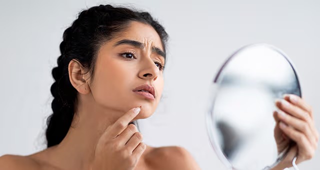 பருக்கள், கரும்புள்ளிகளைப் போக்க சிம்பிள் டிப்ஸ்!. இனி வரவே வராது!. இத டிரை பண்ணுங்க!. pimples