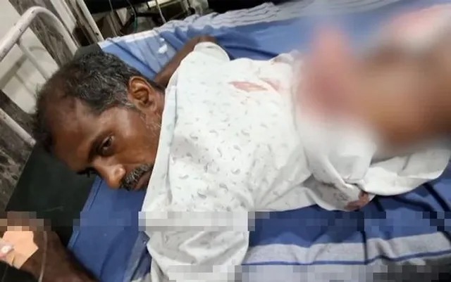 கரூரில் பயங்கரம்!. விவசாயி மீது மர்மநபர்கள் துப்பாக்கிச்சூடு!. முதுகில் பாய்ந்த 10 குண்டுகள்! karur gun shot