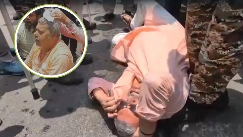 west bengal mp attack