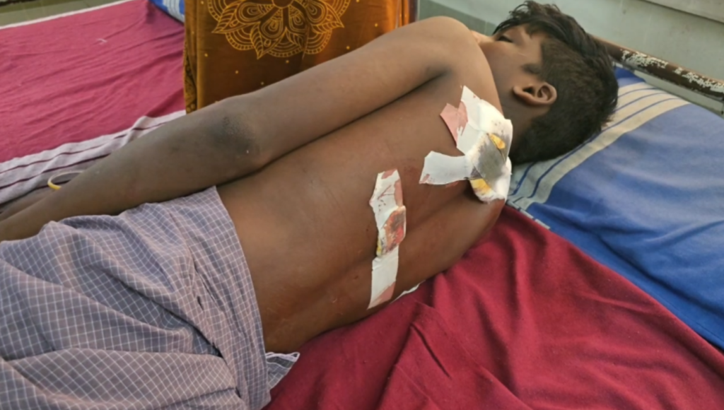 அரசு பள்ளி வளாகத்தில் பகீர் சம்பவம்..!! 12ம் வகுப்பு மாணவனுக்கு கத்திக்குத்து..!! சக மாணவன் வெறிச்செயல்..!! Screenshot 2026 07 15 at 1.36.09 PM